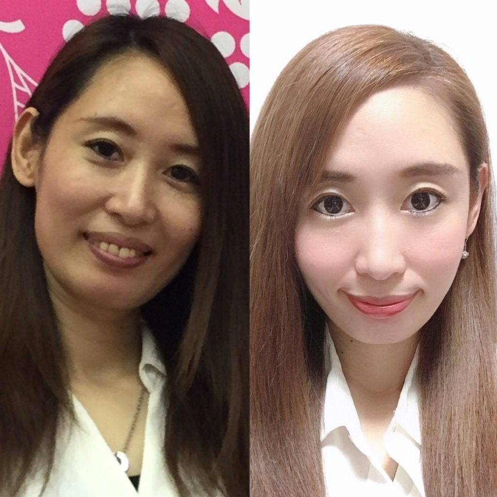 顔のむくみ