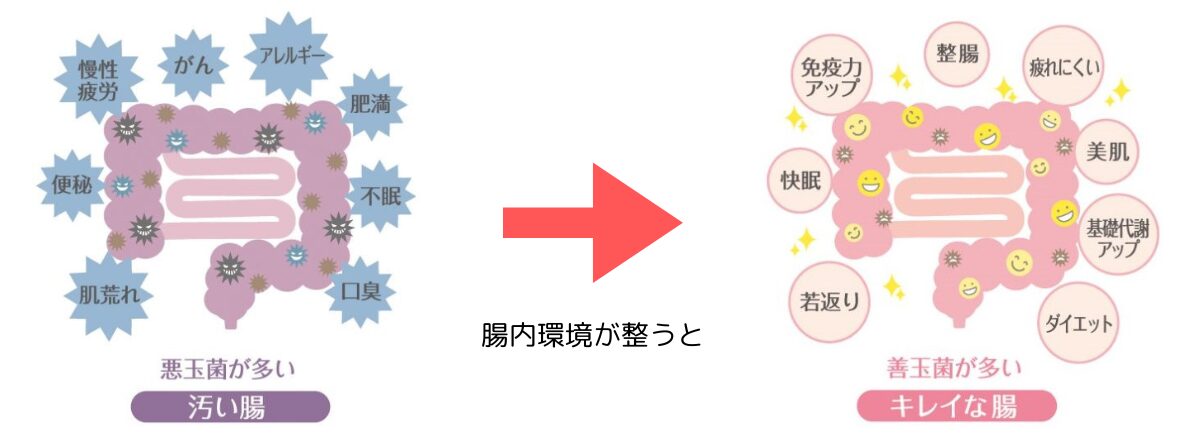 腸内環境が悪いと身体に様々な不具合が起こります